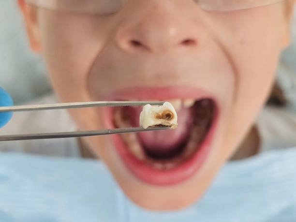 Best Emergency Care for Gum Disease in Calcium, NY